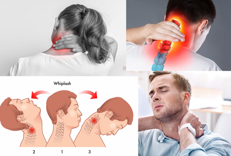 1732113371.696284_851690_image