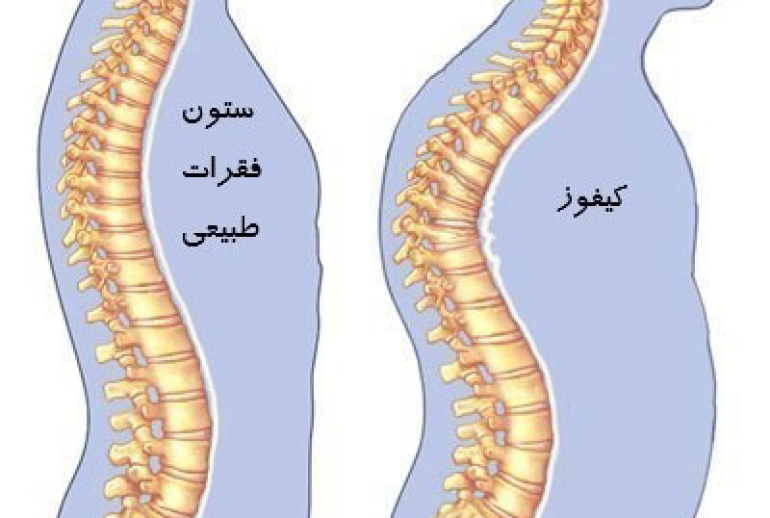 1732113437.143603_272771_image